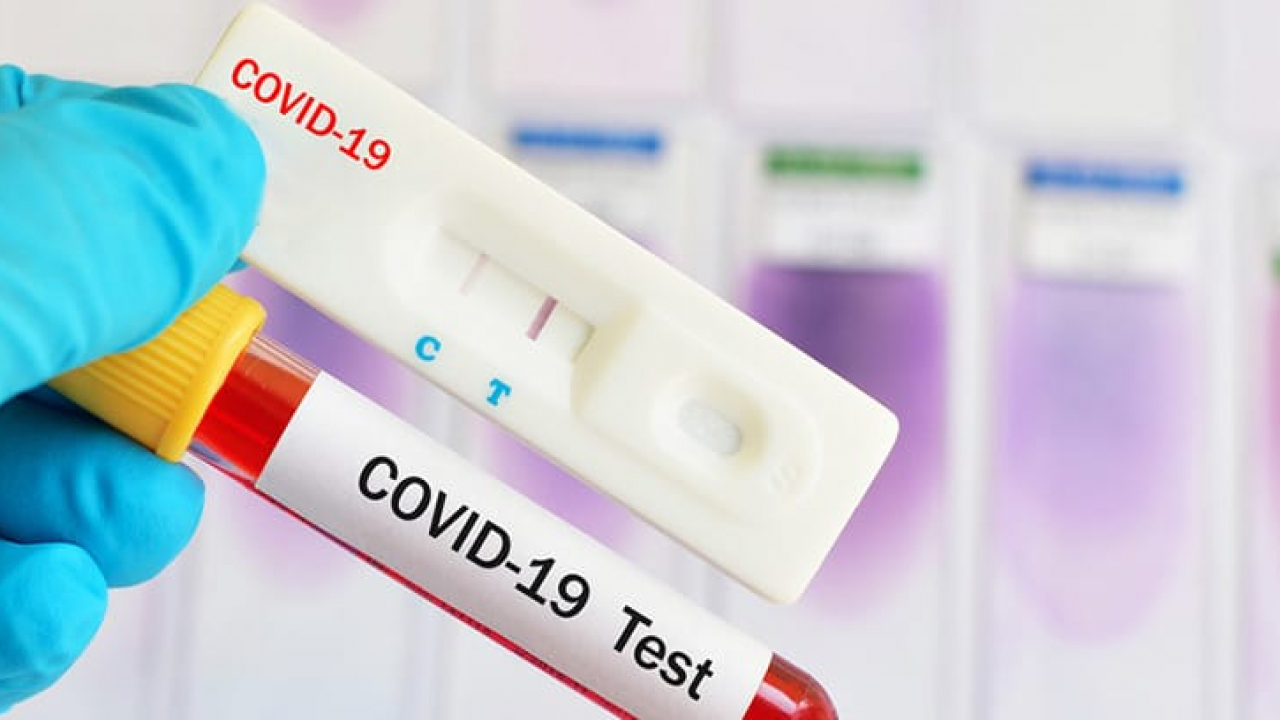 Test coronavirus