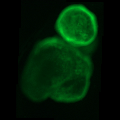 Organoides, miniórganos humanos diseñados en el laboratorio a partir de células madre