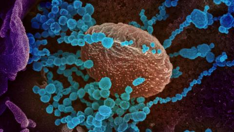 Coronavirus SARS-CoV-2 Coronavirus SARS-CoV-2