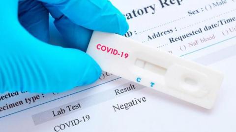 estudio de seroprevalencia de la COVID-19