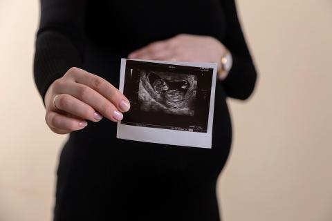 Mujer embarazada sosteniendo ecografía